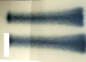 Bild­3:­Der­Kunde­fertigte­Spritz­ bilder­an.­Sie­wiesen­die­Form­ eines­Knochens­auf­und­bestä­ tigten­den­Verdacht­einer­unzu­ reichenden­Geometrie.